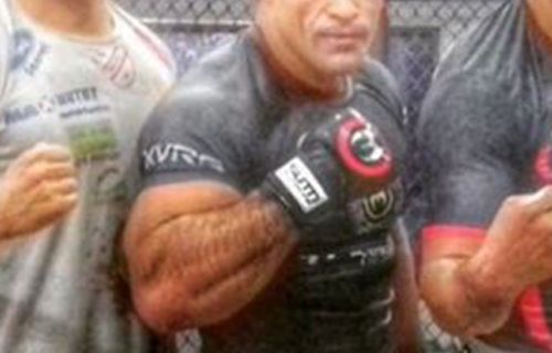 Palhares forearm 2