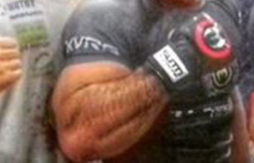 Palhares forearm 3
