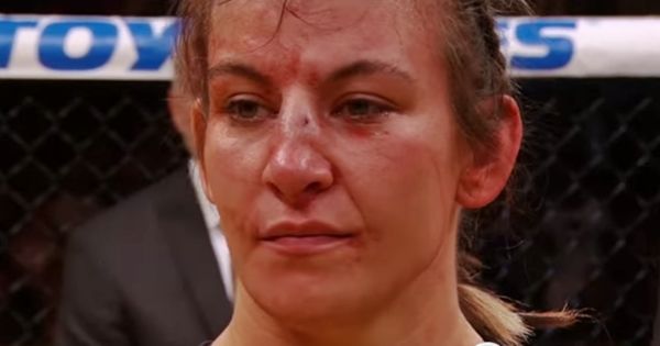 PICS Miesha Tates Nose Was In An Awful State After Her.