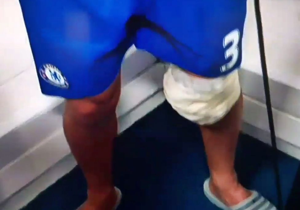 Luiz knee